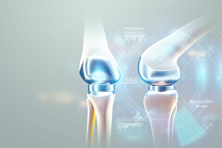 Prosthesis and Orthopaedic Solutions
